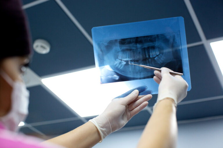 radiología dental