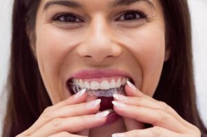 duele invisalign